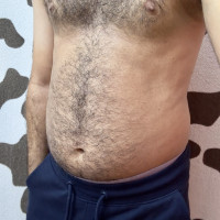 Hairy thick