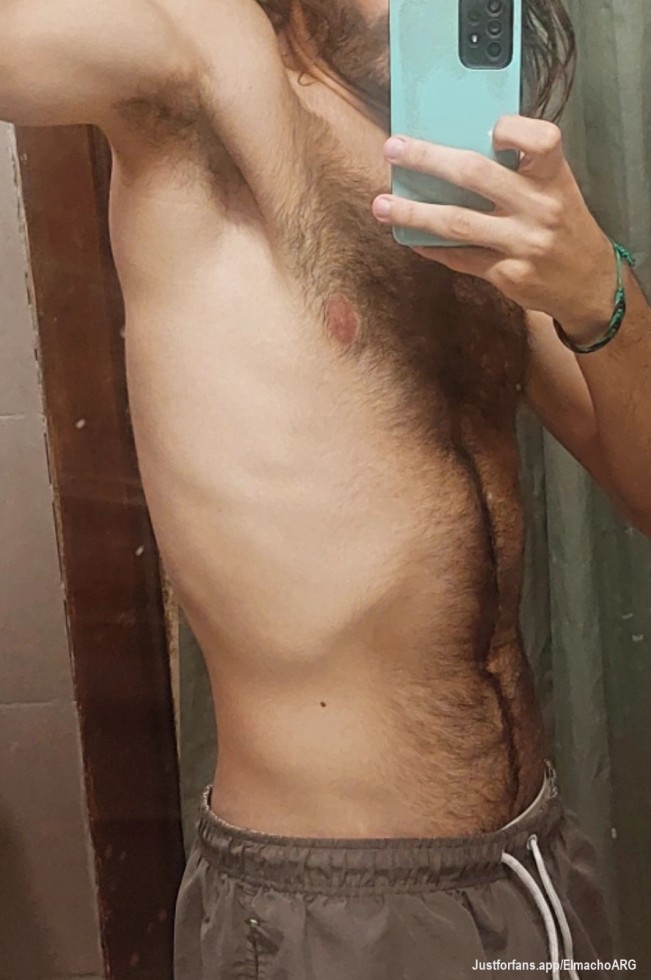 Hot