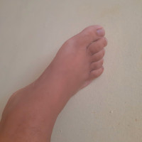 Hot feet