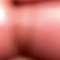 John Doe
