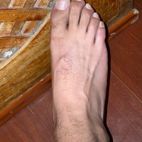 Pie Desnudo
