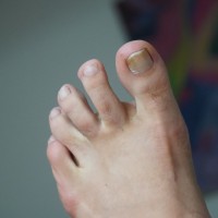 Tyago's Feet